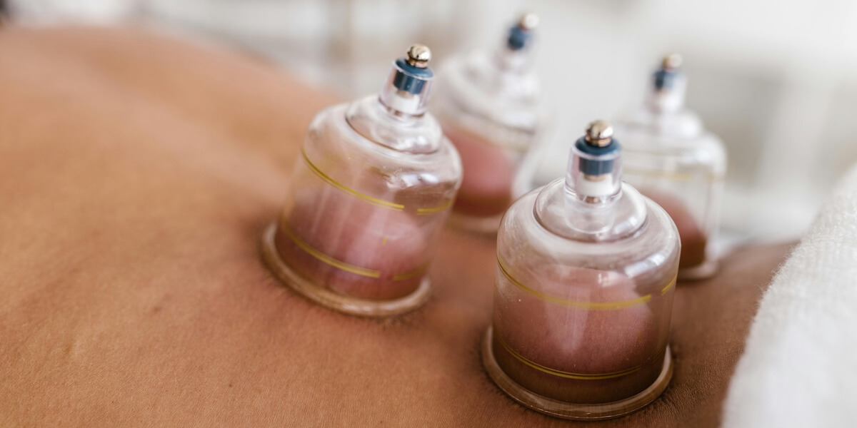 Cupping Therapy service photo